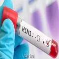 Swine Flu Cases Surge in Delhi, Total Infections Cross 1,770