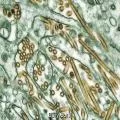 Sydney Reports First Confirmed Case of H5N1 Bird Flu