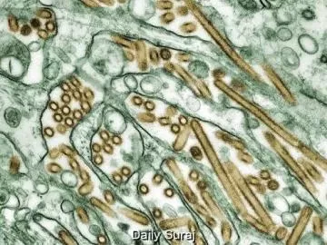 Sydney Reports First Confirmed Case of H5N1 Bird Flu